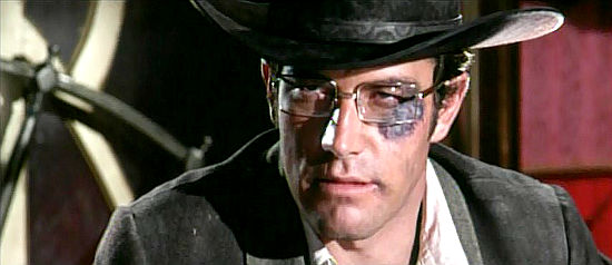 Richard Harrison as Stan, sporting the bruises from an encounter with Ferguson's men in One After Another (1968) 